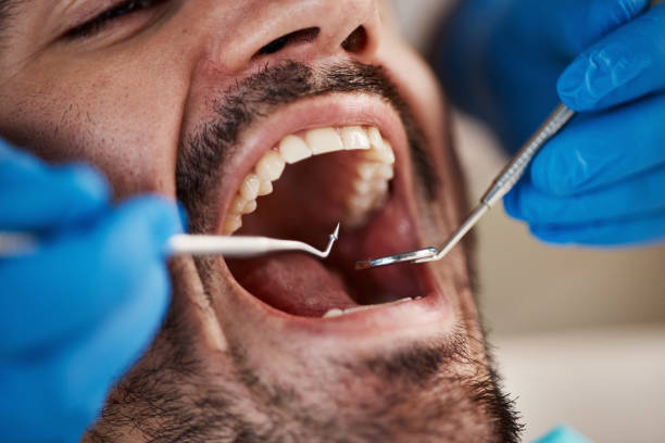 Best Weekend Emergency Dentist in Edgemont Park, MI